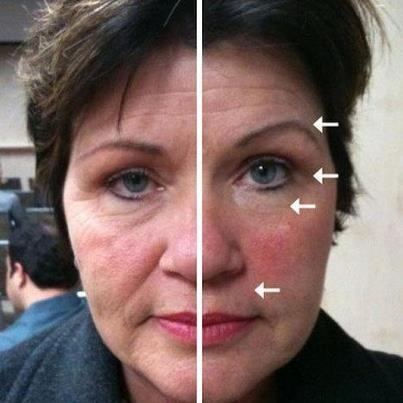 nu-skin-galvanic-spa-adios-arrugas-maquina_MLV-O-5027174367_092013